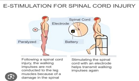Epi-Stim treatment outcomes